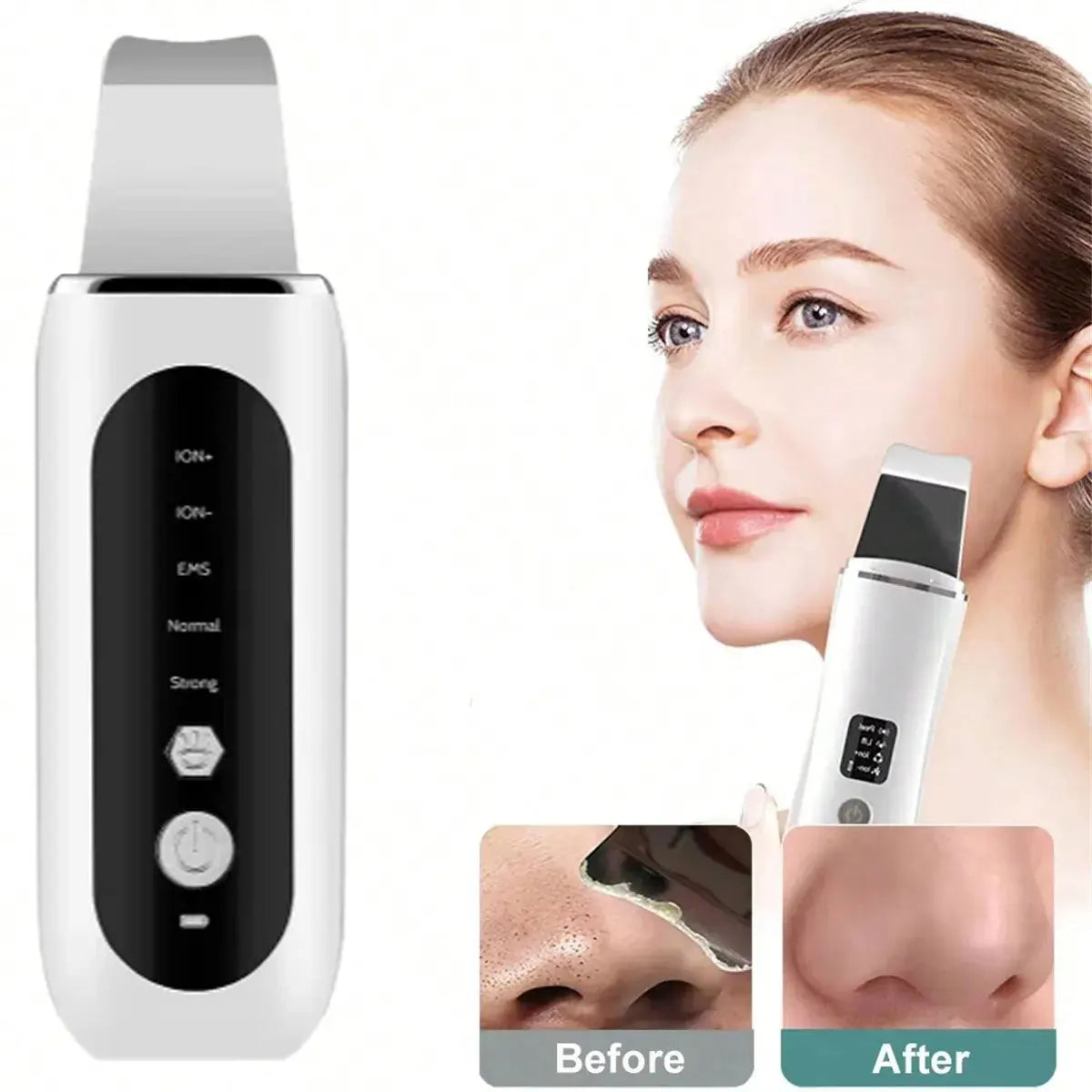 Beauty Products Professional Face Exfoliating Ultrasonic Shovel Facial Peel Cleaner Skin Scrubber Spatula Skin Care Tools